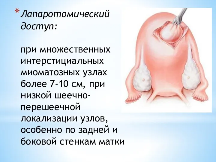 Лапаротомический доступ: при множественных интерстициальных миоматозных узлах более 7-10 см, при низкой