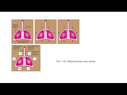 Рис. 7-20. Эластическая тяга легких