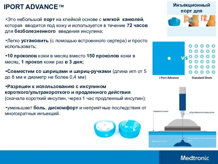 IPORT ADVANCE™ Это небольшой порт на клейкой основе с мягкой канюлей, которая