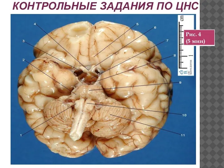 КОНТРОЛЬНЫЕ ЗАДАНИЯ ПО ЦНС