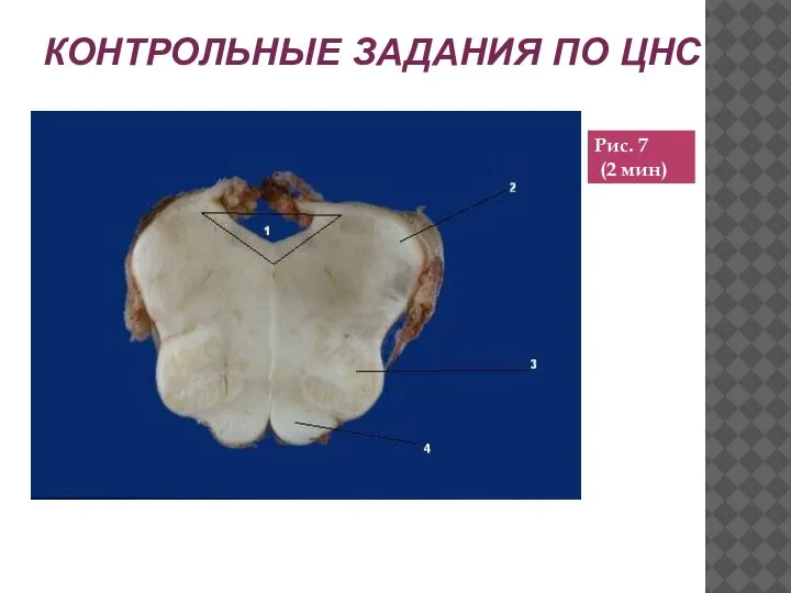 КОНТРОЛЬНЫЕ ЗАДАНИЯ ПО ЦНС