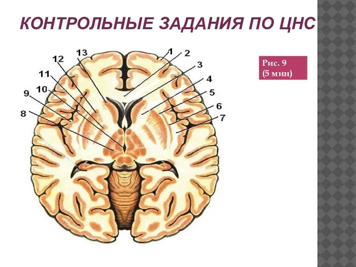 КОНТРОЛЬНЫЕ ЗАДАНИЯ ПО ЦНС