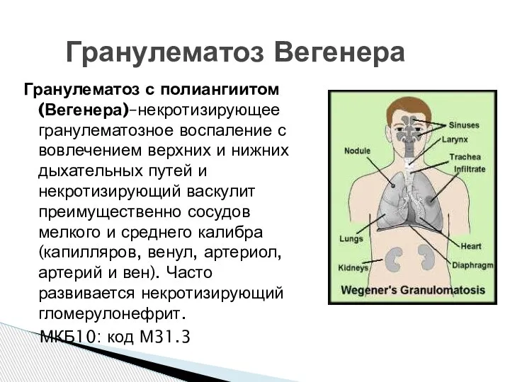 Гранулематоз Вегенера Гранулематоз с полиангиитом (Вегенера)–некротизирующее гранулематозное воспаление с вовлечением верхних и