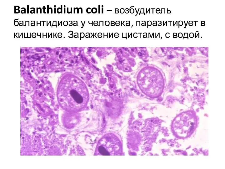 Balanthidium coli – возбудитель балантидиоза у человека, паразитирует в кишечнике. Заражение цистами, с водой.
