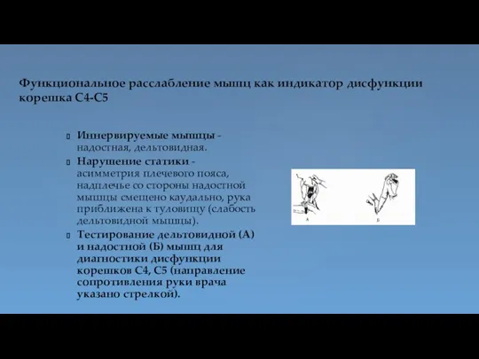 Функциональное расслабление мышц как индикатор дисфункции корешка С4-С5 Иннервируемые мышцы - надостная,