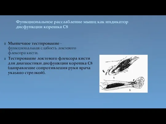 Функциональное расслабление мышц как индикатор дисфункции корешка С8 Мышечное тестирование - функциональная