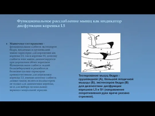 Функциональное расслабление мышц как индикатор дисфункции корешка L5 Мышечное тестирование - функциональная