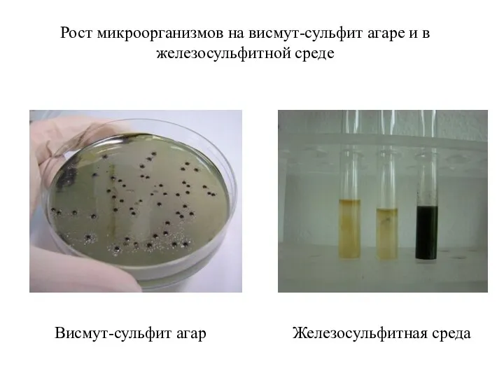 Рост микроорганизмов на висмут-сульфит агаре и в железосульфитной среде Висмут-сульфит агар Железосульфитная среда