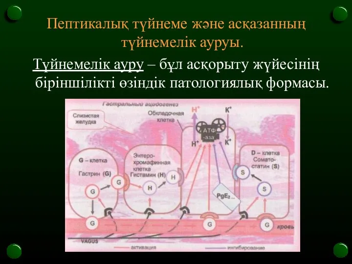 Пептикалық түйнеме және асқазанның түйнемелік ауруы. Түйнемелік ауру – бұл асқорыту жүйесінің біріншілікті өзіндік патологиялық формасы.