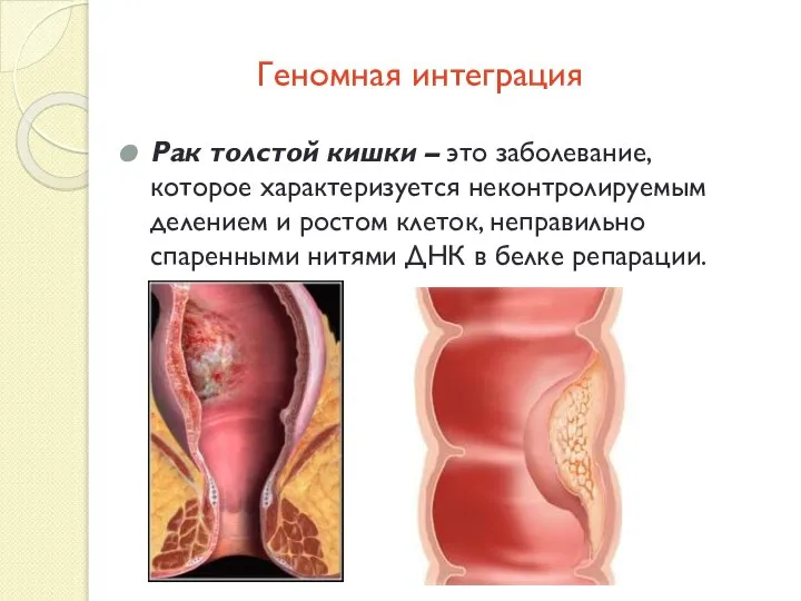 Геномная интеграция Рак толстой кишки – это заболевание, которое характеризуется неконтролируемым делением