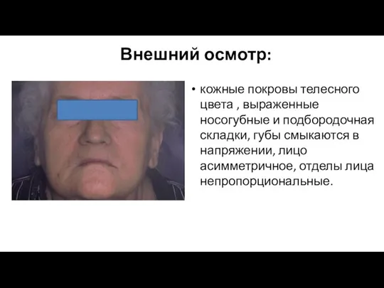 Внешний осмотр: кожные покровы телесного цвета , выраженные носогубные и подбородочная складки,