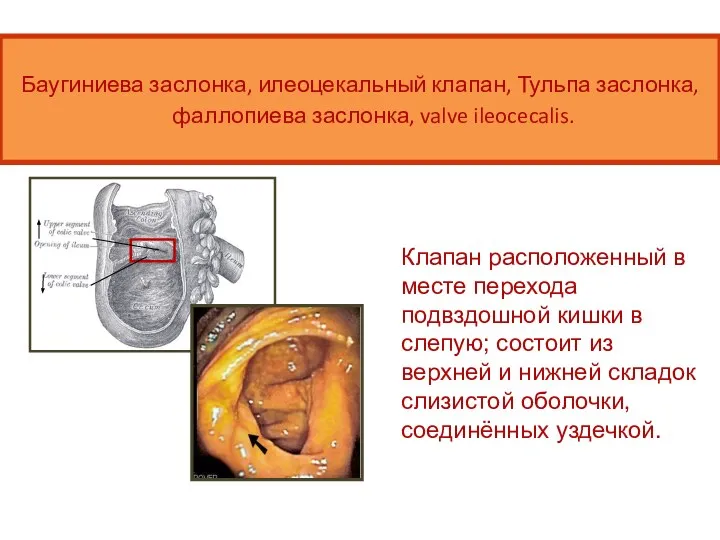 Баугиниева заслонка, илеоцекальный клапан, Тульпа заслонка, фаллопиева заслонка, valve ileocecalis. Клапан расположенный