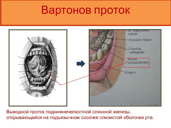Вартонов проток Выводной проток поднижнечелюстной слюнной железы, открывающейся на подъязычном сосочке слизистой оболочки рта.