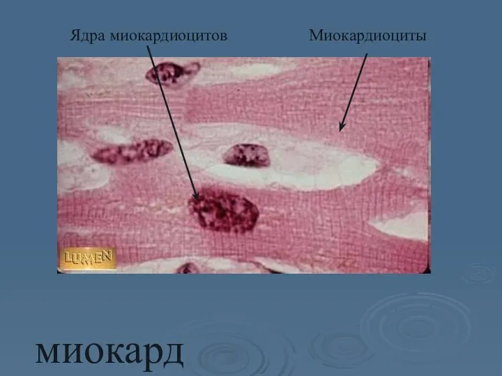 миокард