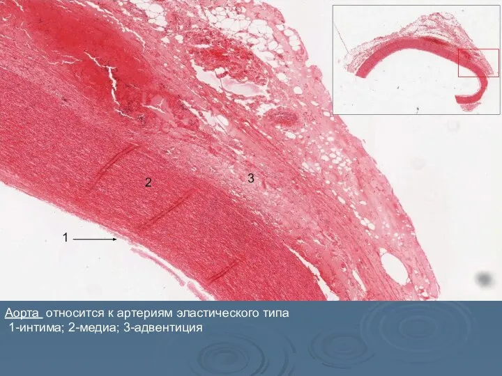 Аорта относится к артериям эластического типа 1-интима; 2-медиа; 3-адвентиция 1 2 3 1 2