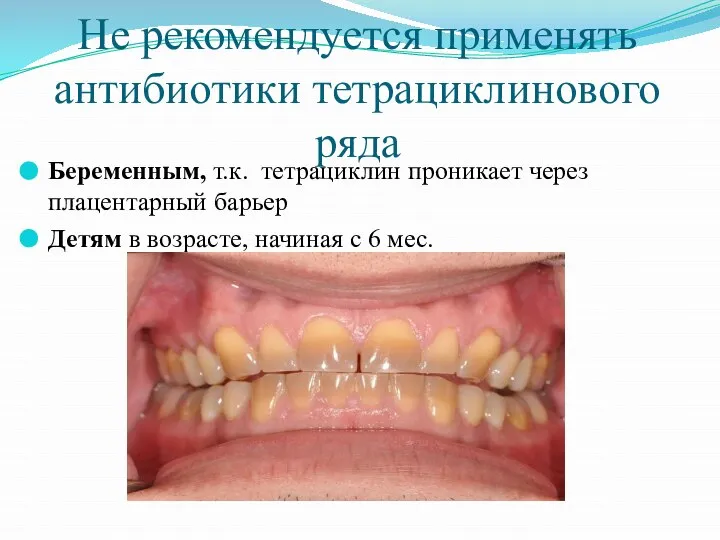 Не рекомендуется применять антибиотики тетрациклинового ряда Беременным, т.к. тетрациклин проникает через плацентарный