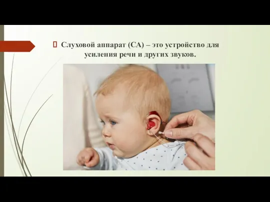 Слуховой аппарат (СА) – это устройство для усиления речи и других звуков.