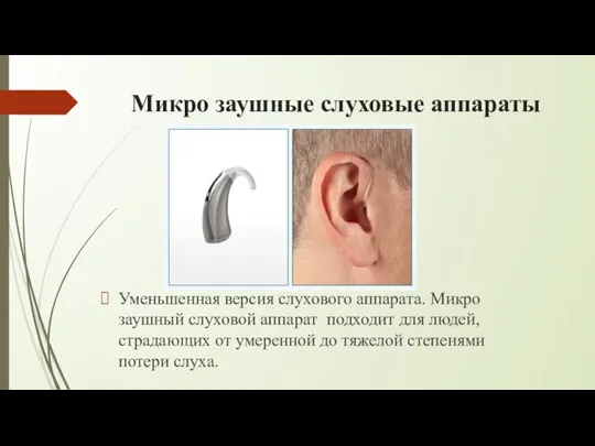 Микро заушные слуховые аппараты Уменьшенная версия слухового аппарата. Микро заушный слуховой аппарат