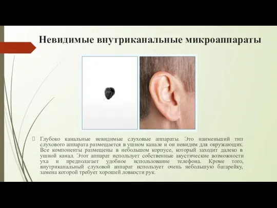 Глубоко канальные невидимые слуховые аппараты. Это наименьший тип слухового аппарата размещается в