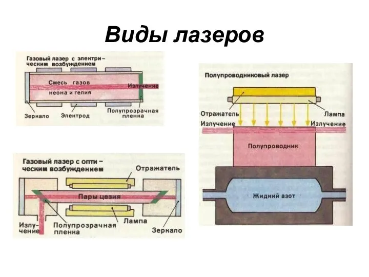 Виды лазеров