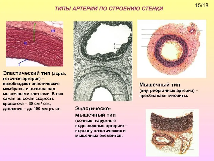 ТИПЫ АРТЕРИЙ ПО СТРОЕНИЮ СТЕНКИ Эластический тип (аорта, легочная артерия) – преобладают