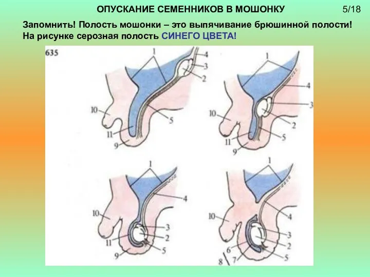 ОПУСКАНИЕ СЕМЕННИКОВ В МОШОНКУ Запомнить! Полость мошонки – это выпячивание брюшинной полости!