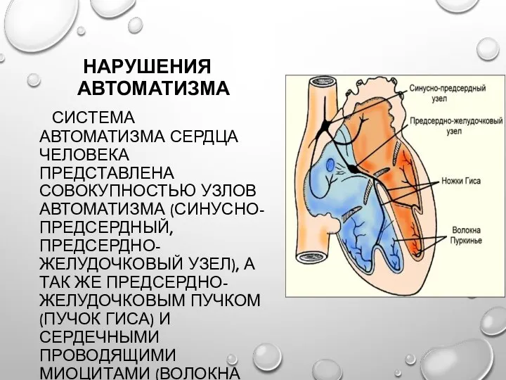 НАРУШЕНИЯ АВТОМАТИЗМА СИСТЕМА АВТОМАТИЗМА СЕРДЦА ЧЕЛОВЕКА ПРЕДСТАВЛЕНА СОВОКУПНОСТЬЮ УЗЛОВ АВТОМАТИЗМА (СИНУСНО-ПРЕДСЕРДНЫЙ, ПРЕДСЕРДНО-ЖЕЛУДОЧКОВЫЙ