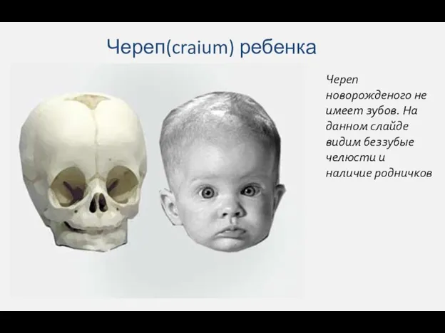 Череп(craium) ребенка Череп новорожденого не имеет зубов. На данном слайде видим беззубые челюсти и наличие родничков