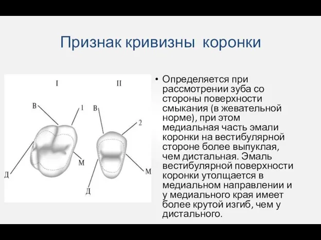 Признак кривизны коронки Определяется при рассмотрении зуба со стороны поверхности смыкания (в