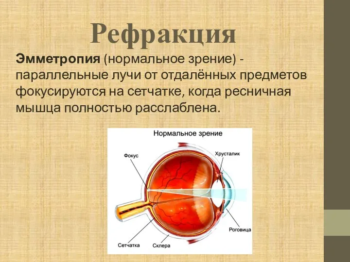 Рефракция Эмметропия (нормальное зрение) - параллельные лучи от отдалённых предметов фокусируются на