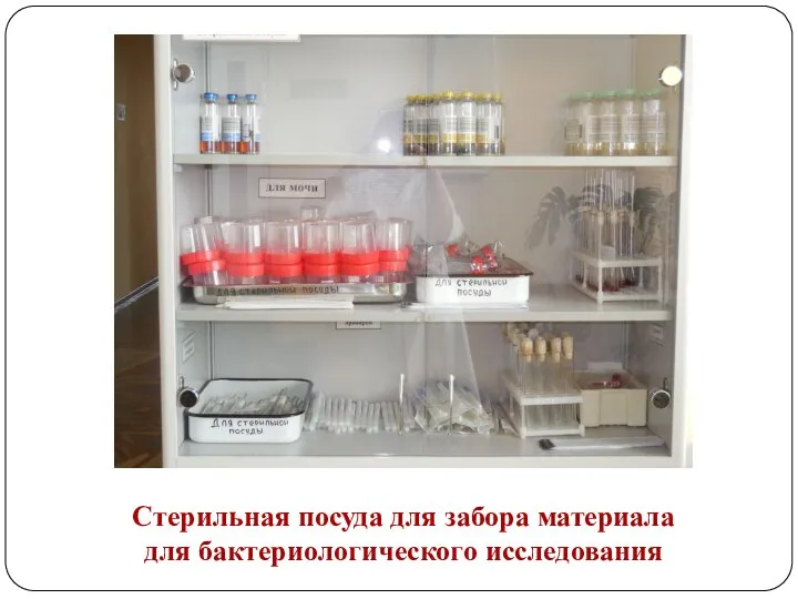 Стерильная посуда для забора материала для бактериологического исследования