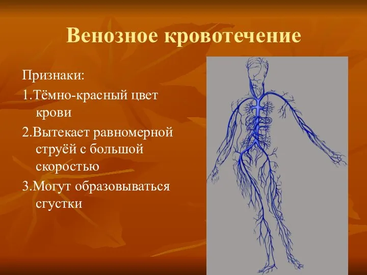 Венозное кровотечение Признаки: 1.Тёмно-красный цвет крови 2.Вытекает равномерной струёй с большой скоростью 3.Могут образовываться сгустки