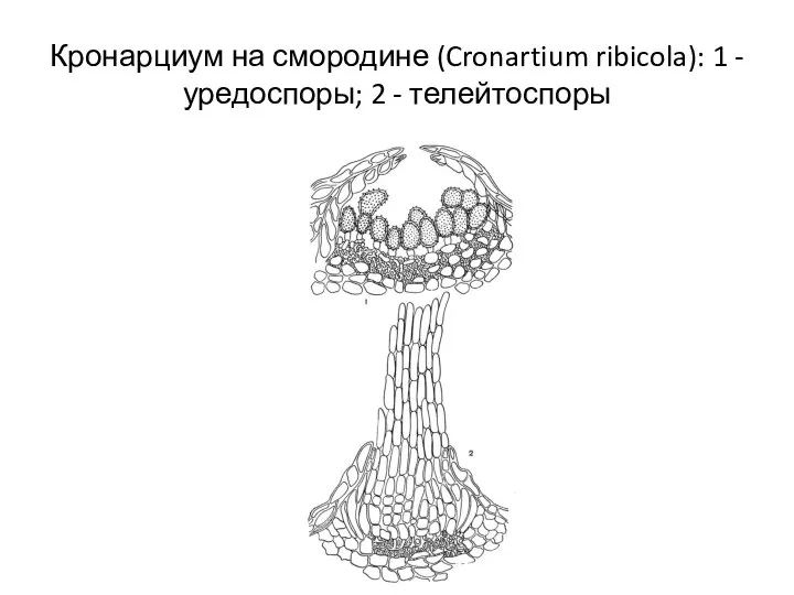 Кронарциум на смородине (Cronartium ribicola): 1 - уредоспоры; 2 - телейтоспоры