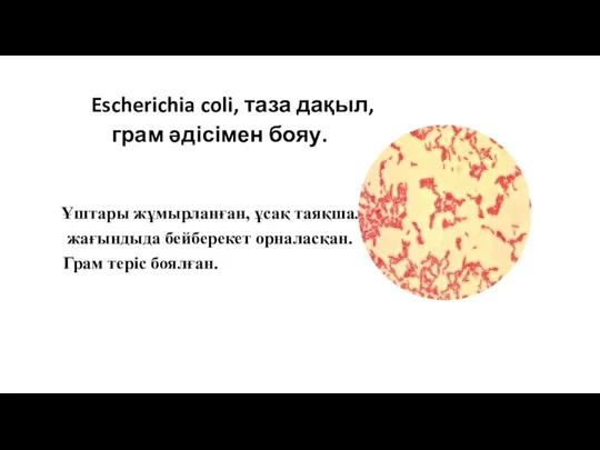 Escherichia coli, таза дақыл, грам әдісімен бояу. Ұштары жұмырланған, ұсақ таяқшалар, жағындыда