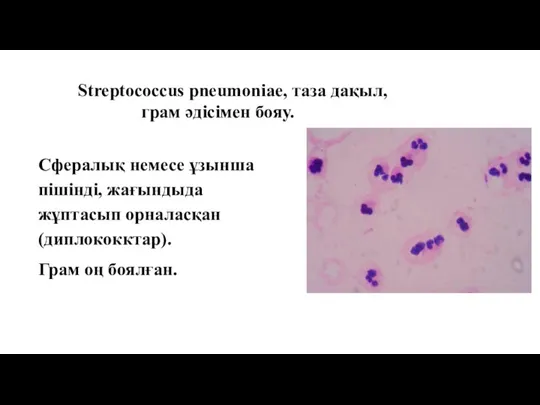 Streptococcus pneumoniae, таза дақыл, грам әдісімен бояу. Сфералық немесе ұзынша пішінді, жағындыда