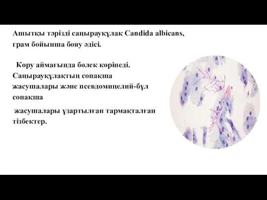 Ашытқы тәрізді саңырауқұлақ Candida albicans, грам бойынша бояу әдісі. Көру аймағында бөлек