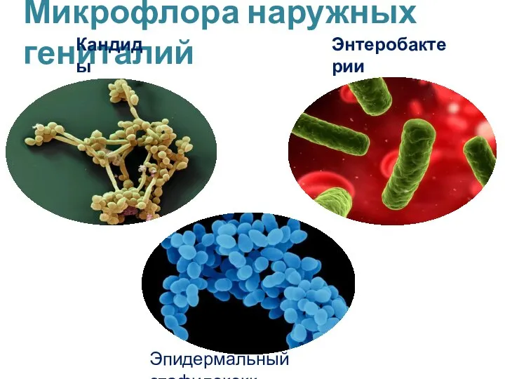 Эпидермальный стафилококк Микрофлора наружных гениталий Энтеробактерии Кандиды