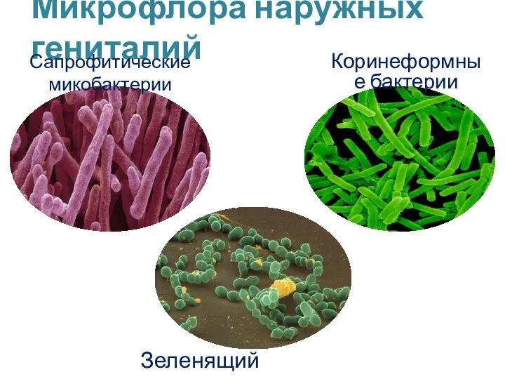Микрофлора наружных гениталий Зеленящий стрептококк Сапрофитические микобактерии Коринеформные бактерии