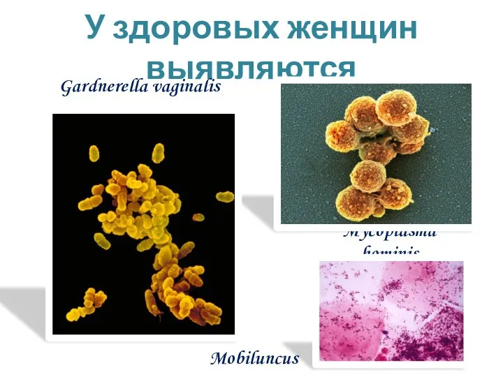 Mycoplasma hominis У здоровых женщин выявляются Gardnerella vaginalis Mobiluncus