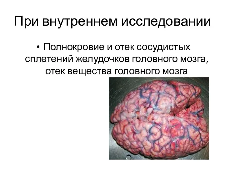При внутреннем исследовании Полнокровие и отек сосудистых сплетений желудочков головного мозга, отек вещества головного мозга