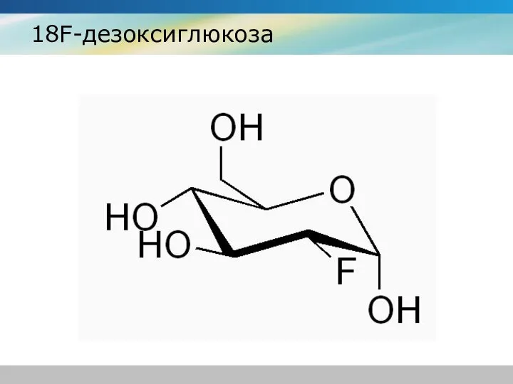 18F-дезоксиглюкоза