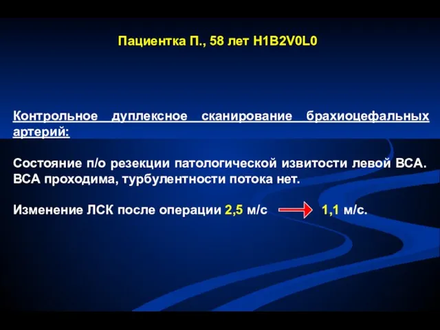 Пациентка П., 58 лет H1B2V0L0 Контрольное дуплексное сканирование брахиоцефальных артерий: Состояние п/о