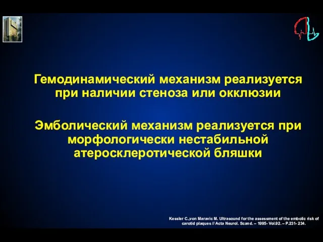 Гемодинамический механизм реализуется при наличии стеноза или окклюзии Эмболический механизм реализуется при