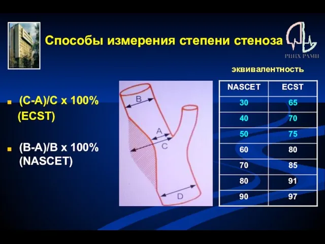 Способы измерения степени стеноза (С-А)/С х 100% (ЕCST) (B-A)/В х 100% (NASCET) эквивалентность