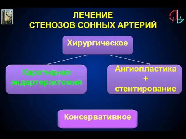 Хирургическое Ангиопластика + стентирование ЛЕЧЕНИЕ СТЕНОЗОВ СОННЫХ АРТЕРИЙ