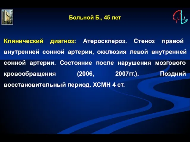 Больной Б., 45 лет Клинический диагноз: Атеросклероз. Стеноз правой внутренней сонной артерии,