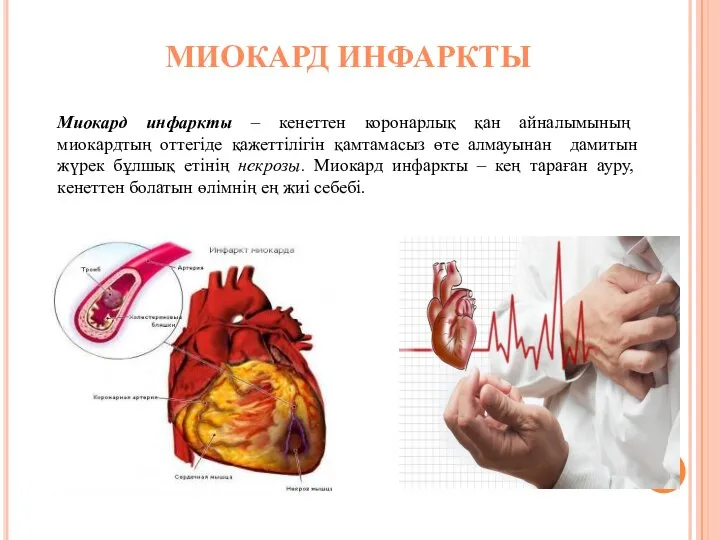 МИОКАРД ИНФАРКТЫ Миокард инфаркты – кенеттен коронарлық қан айналымының миокардтың оттегіде қажеттілігін