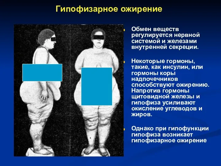 Гипофизарное ожирение Обмен веществ регулируется нервной системой и железами внутренней секреции. Некоторые
