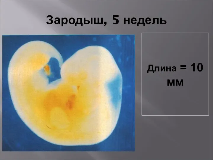 Зародыш, 5 недель Длина = 10 мм