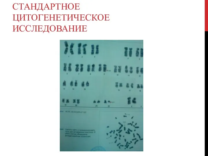 СТАНДАРТНОЕ ЦИТОГЕНЕТИЧЕСКОЕ ИССЛЕДОВАНИЕ